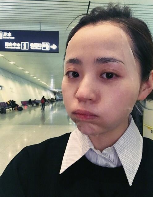 张靓颖在机场素颜敷面膜：眼眶黑眼圈清晰可见！但皮肤状态依然姣好